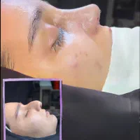 جراحی بینی لیفت سینه لیپومامو ژنیکو پیکر ابدوپروتز|خدمات آرایشگری و زیبایی|تهران, علم و صنعت|دیوار