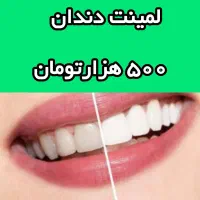 ریمو استارO