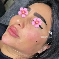 جشنواره ژل و بوتاکس|خدمات آرایشگری و زیبایی|تهران, جوادیه تهرانپارس|دیوار