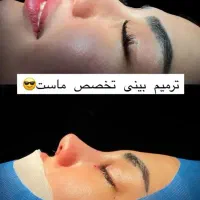 جشنواره جراحی بینی|خدمات آرایشگری و زیبایی|سقز, |دیوار