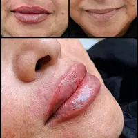مرکزخدمات زیبایی درمانی دکتر سیدعلی پورحسینیGP|خدمات آرایشگری و زیبایی|رفسنجان, |دیوار