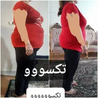 لاغری بدون ورزش و رژیم سخت