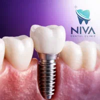 دندانپزشکی نیوا|خدمات آرایشگری و زیبایی|تهران, اختیاریه|دیوار