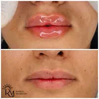 جشنواره  زیبایی کلینیک دکتر محمودی|خدمات آرایشگری و زیبایی|کرمان, |دیوار