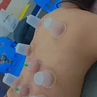 آموزش حجامت توسط پرستارخانوم|خدمات آموزشی|برازجان, |دیوار