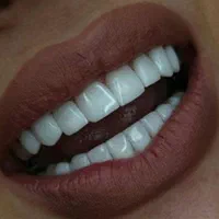 آف ویژه کامپوزیت کامپوزیت ونیر|خدمات آرایشگری و زیبایی|تهران, قیطریه|دیوار