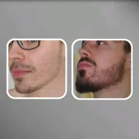 بلیت کنسرت ریش