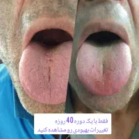 پاکسازی بدن از سموم با گیاهان دارویی