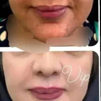 کرم وی ای پی اصل صدرصد تضمینی و بدون بازگشت