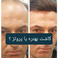 خدمات پروتز و ترمیم مو/پروتز دائم/پروتز مو|خدمات آرایشگری و زیبایی|اصفهان, وحید|دیوار