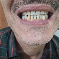 دندانسازی متحرک(شرایط خوب)|خدمات آرایشگری و زیبایی|قیدار, |دیوار