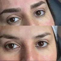 مدل فیبروز ابرو