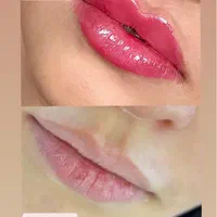 تزریق ژل لب و بوتاکس تضمینی|خدمات آرایشگری و زیبایی|تهران, خانی‌آباد|دیوار