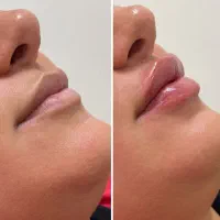 خدمات زیبایی تخصصی در جوانرود و روانسر