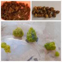 سنگ کلیه و صفرا، معده و کبد|خدمات آرایشگری و زیبایی|زابل, |دیوار