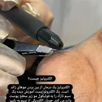 ژل وبوتاکس|خدمات آرایشگری و زیبایی|اهواز, پردیس دو|دیوار