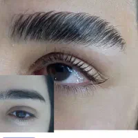 کاشت هیدن ولیفت مژه وابرو