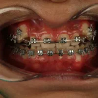 دندانپزشکی/ترمیم/کامپوزیت/لمینیت/عصبکشی قسطی|خدمات آرایشگری و زیبایی|مشهد, سجاد شهر|دیوار