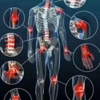 کیسه نمک درمانی برقی گزینه جایگزین کیسه آب گرم