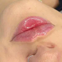 کلینیک پوست و مو|خدمات آرایشگری و زیبایی|تهران, ستارخان|دیوار