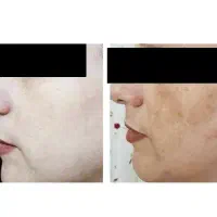 کرم سفید کننده طبیعی