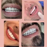 دندانپزشکی با تعرفه دولتی