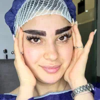 کاشت ابرو