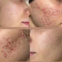 جشنواره مطب زیبایی ماهورا|خدمات آرایشگری و زیبایی|قروه, |دیوار