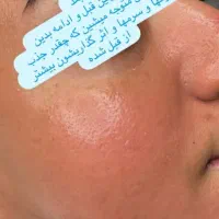 فشیال وپاکسازی|خدمات آرایشگری و زیبایی|شیراز, شهرک فرهنگیان|دیوار