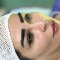 کاشت مو  و ابرو به روش سوپر fue پلاس(fue-sfue)|خدمات آرایشگری و زیبایی|شیراز, قدوسی غربی|دیوار