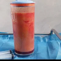 انجام تمامی خدمات فیلرو ساکشن و لابیا پلاستی|خدمات آرایشگری و زیبایی|کرمانشاه, |دیوار