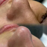 پاکسازی پوست و فیشیال تخصصی ویژه بانوان