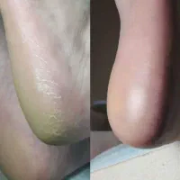 مدل کفسابی پا