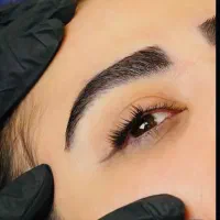 کاشت ابرو به روش ایج لیفت