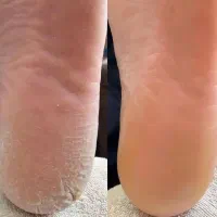 وسایل پدیکور
