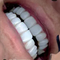 پذیرش دندانپزشکی