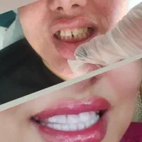 جشنواره شهریورکامپوزیت، لمینت،ایمپلنت|خدمات آرایشگری و زیبایی|رباط‌کریم, نصیرشهر|دیوار