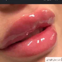 ژل بوتاکس فیلر ،خالبرداری، آموزش فیشیال وپاکسازی|خدمات آرایشگری و زیبایی|شیراز, منطقه هوایی شهید دوران|دیوار