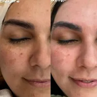 پاکسازی پوست و جوان سازی پوست|خدمات آرایشگری و زیبایی|اراک, |دیوار