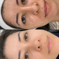 مواد فیشال و پاکسازی پوست