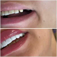 کامپوزیت خرم اباد|خدمات آرایشگری و زیبایی|بروجرد, |دیوار