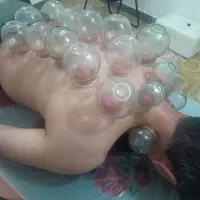 مرکزحجامت وزالودرمانی