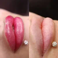 30٪تخفیف خدمات زیبایی میکرو و شیدینگ و...