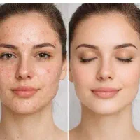 فشیال کار تخصصی