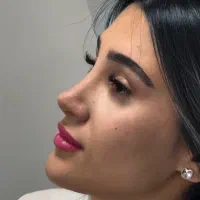 عمل جراحی بینی اقساط ۲۴ ماهه با چک صیادی قسطی