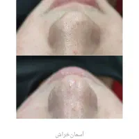 آموزش فشیال( فیشیال) پاکسازی|خدمات آموزشی|قم, سالاریه|دیوار