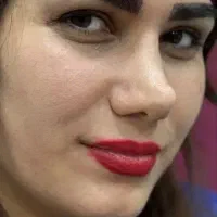 کاشت تخصصی ابرو