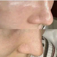 مدل برای فشیال