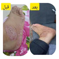 ۱۰۰٪نتیجه|آرایشی، بهداشتی، درمانی|شیراز, احمدآباد|دیوار