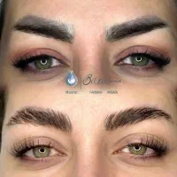 میکروبلیدینگ و ریموو حرفه‌ای|خدمات آرایشگری و زیبایی|اهواز, زیتون کارمندی|دیوار